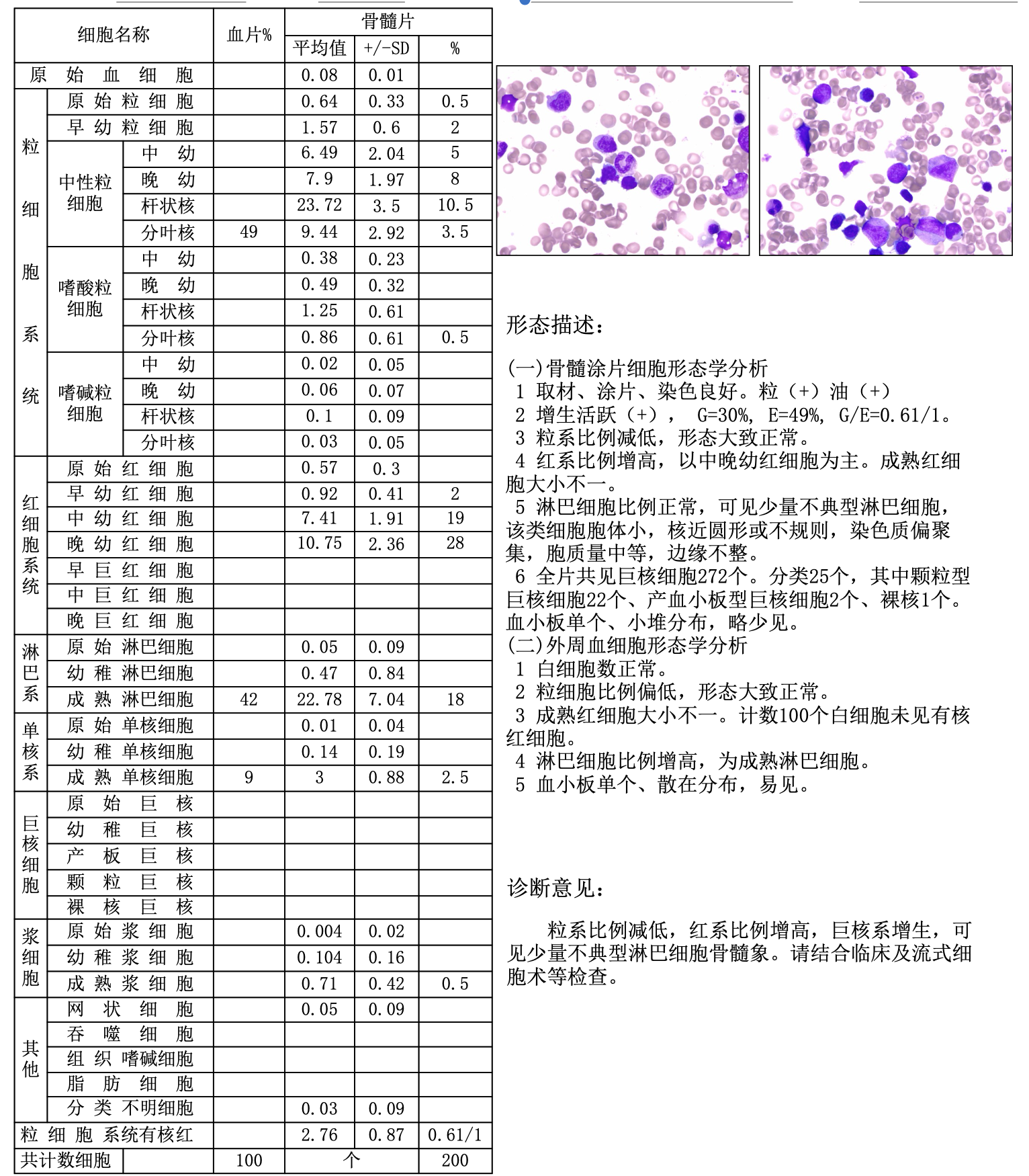 骨髓涂片细胞学检查-髂骨 血(骨髓分类).png