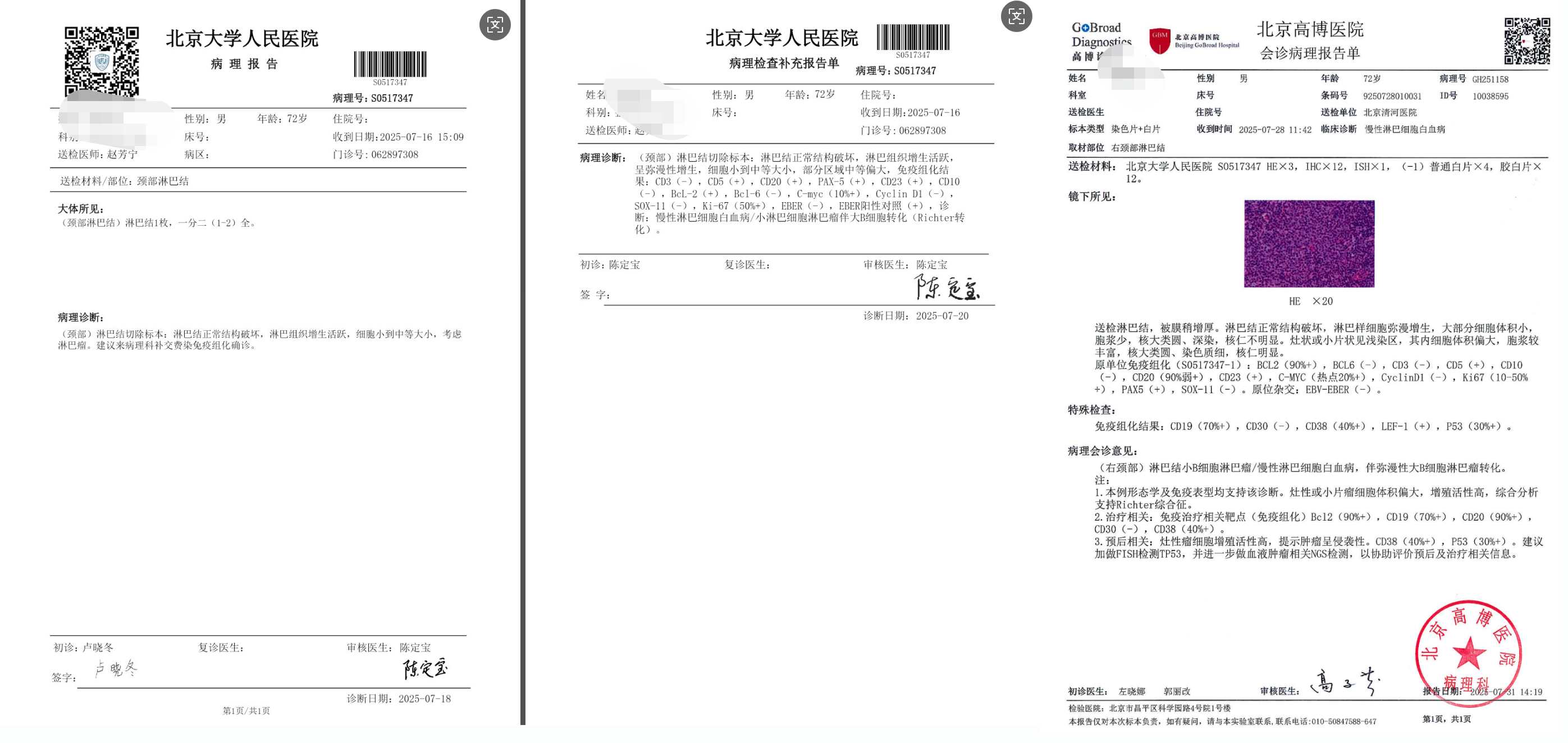 病理报告